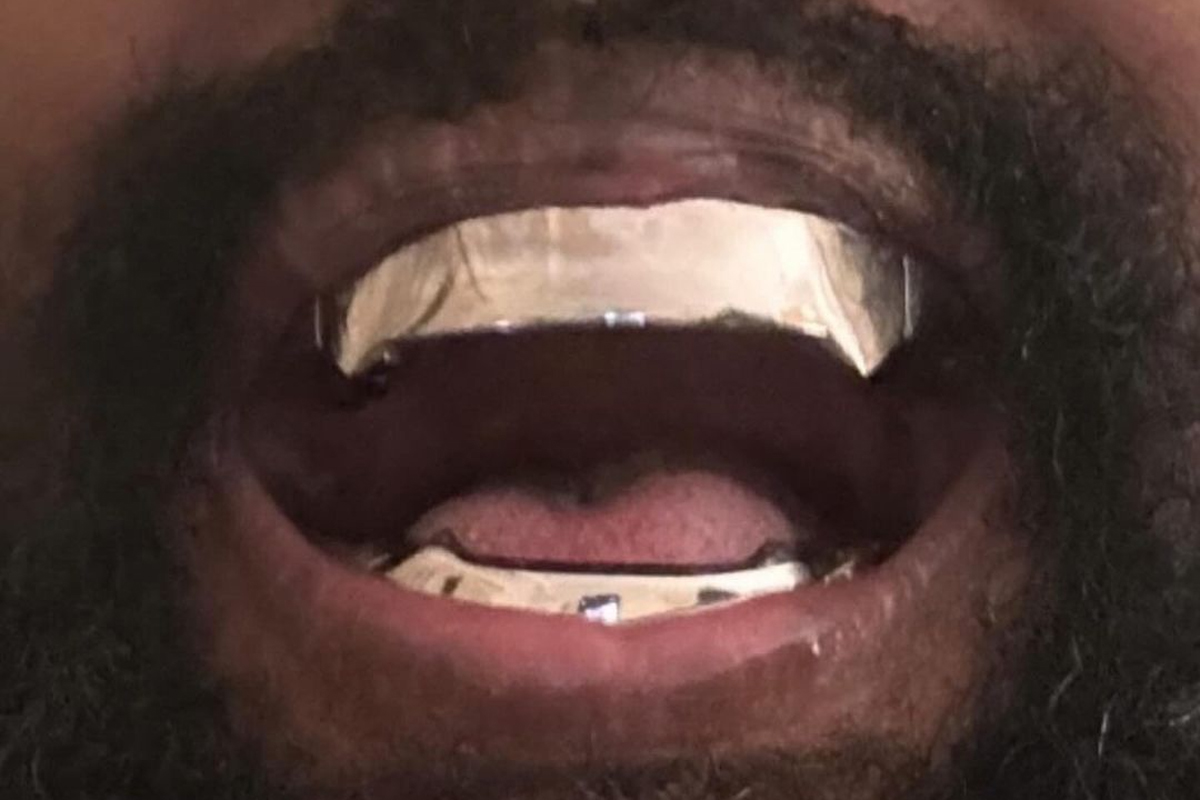 Kanye West denti grillz 850k dollari